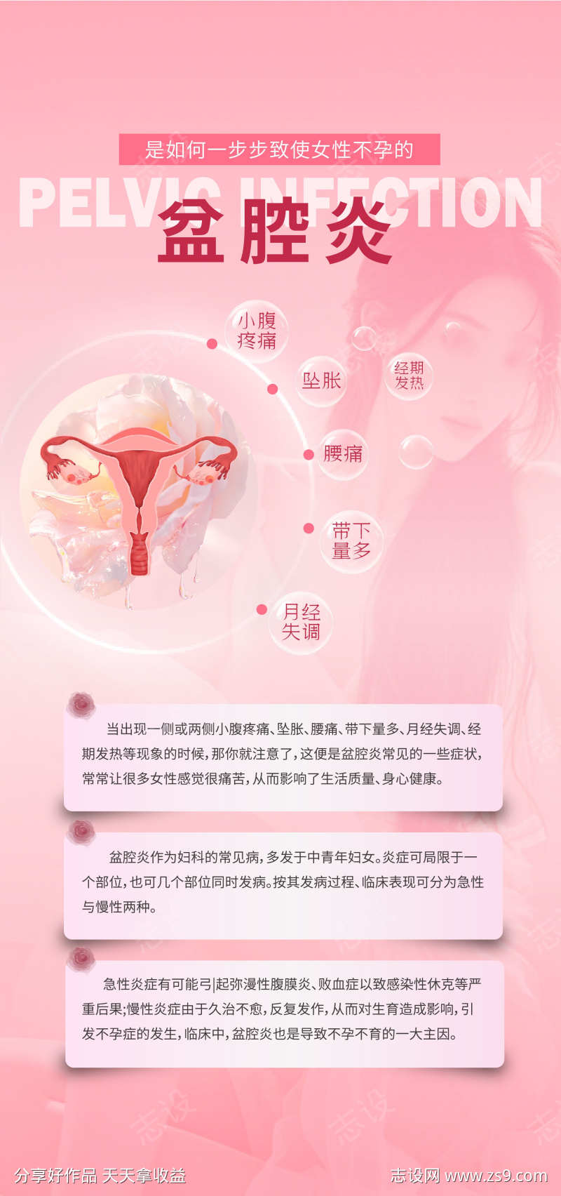 妇科盆腔炎健康海报