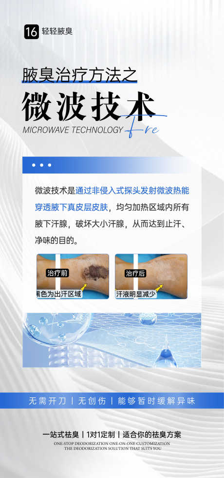 腋臭微波手术海报_源文件下载_AI格式_1080X2300像素-狐臭,腋臭,手术-作品编号:2025092914419399-志͵设˲͓͕͔͐͑͗ٚٛٙ网
