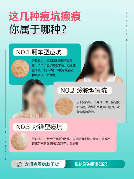 痘痘青春痘科普海报_源文件下载_PSD格式_1080X1440像素-小课堂,医美,美容院-作品编号:2025100909137981-志˙设ʹ֣֤֚֫֗ׄ网