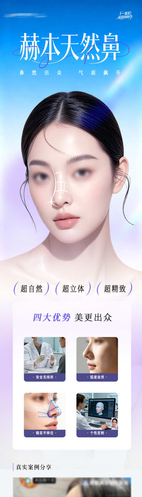 医美赫本天然鼻隆鼻创意案例长图海报_源文件下载_PSD格式_1284X5880像素-鼻基底,鼻综合,鼻子-作品编号:2025100913051065-志ˆ设·网