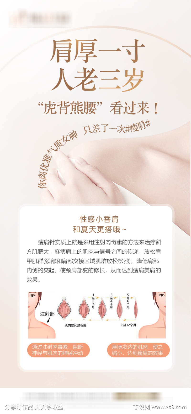 气质直角肩科普