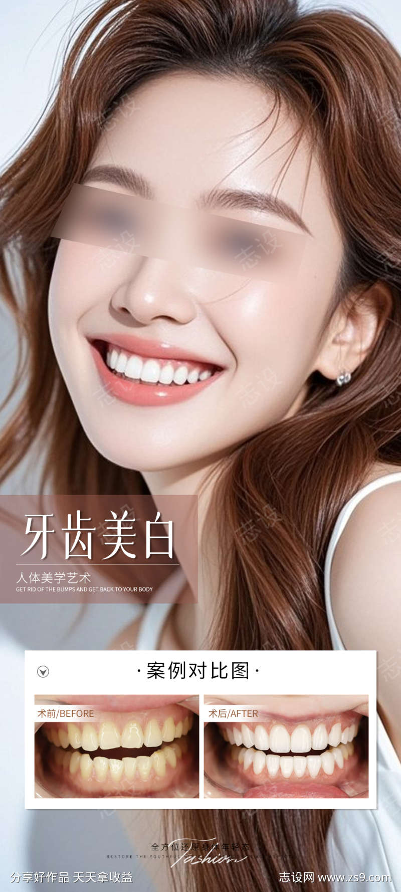 牙齿美白案例海报