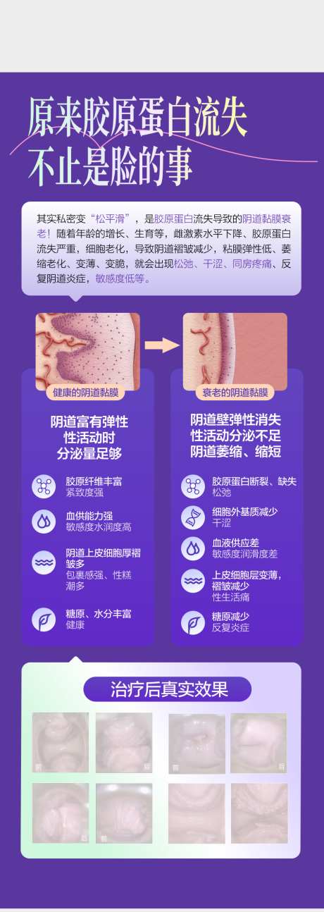私密黏膜修复_源文件下载_CDR格式_938X2638像素-海报,整形,抗衰-作品编号:2025101215229566-志’设’网