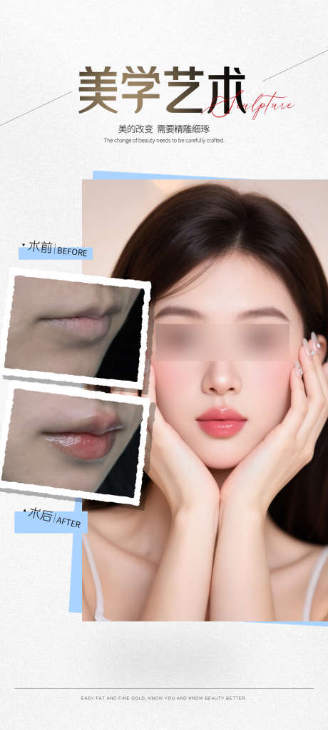 玻尿酸丰唇案例海报_源文件下载_PSD格式_1080X2400像素-海报,案例,嘟嘟唇-作品编号:2025101408406933-志′设˓网