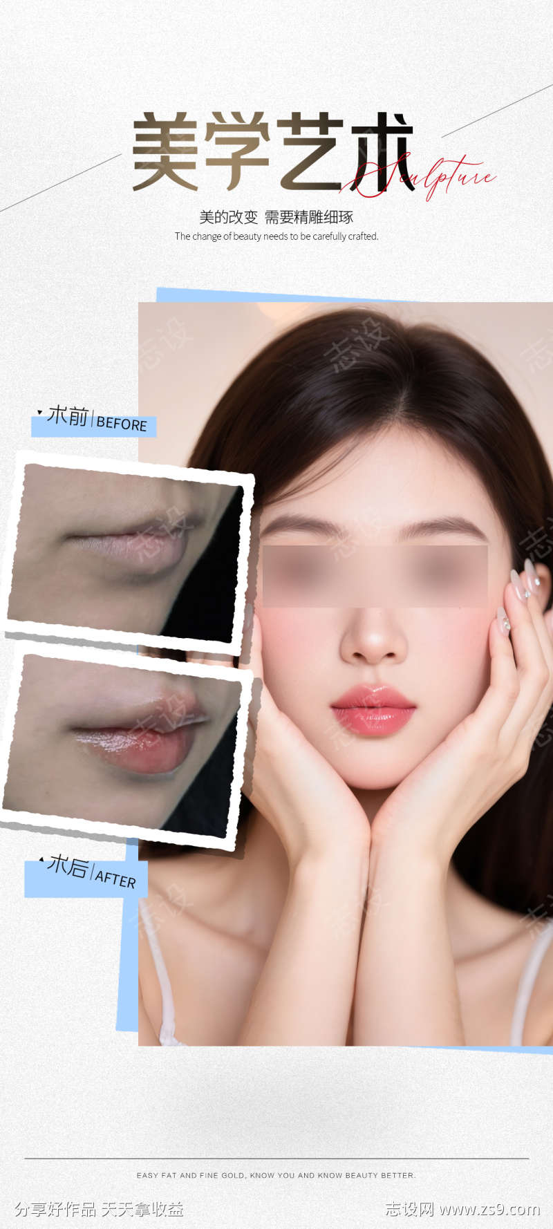 玻尿酸丰唇案例海报