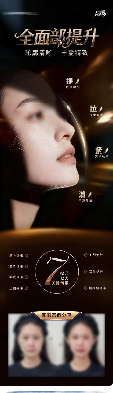 医美全面部提升抗衰案例长图海报_源文件下载_PSD格式_1284X4630像素-除皱,韧带,长图-作品编号:2025101911314248-志˒设·网