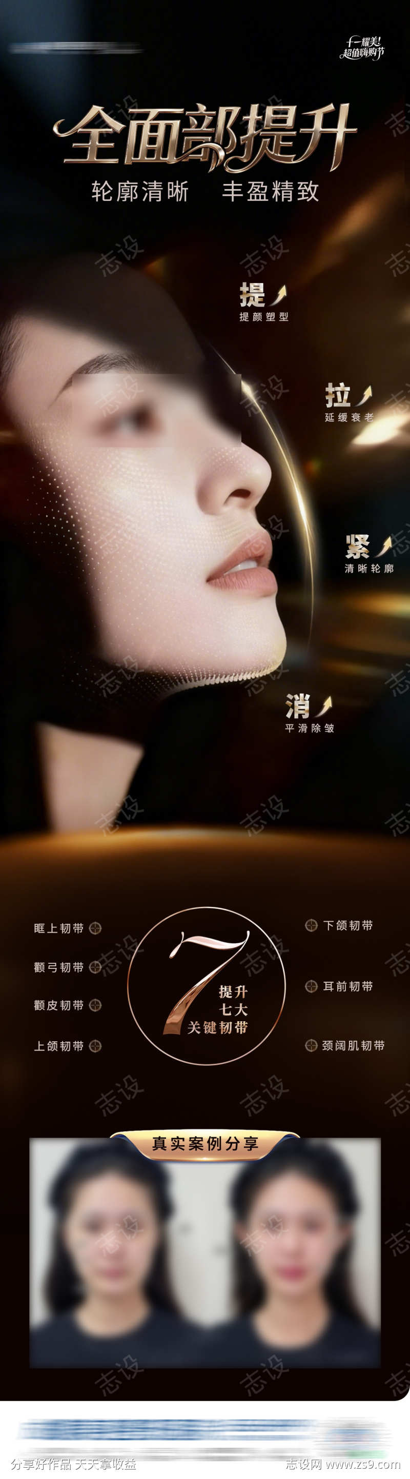 医美全面部提升抗衰案例长图海报