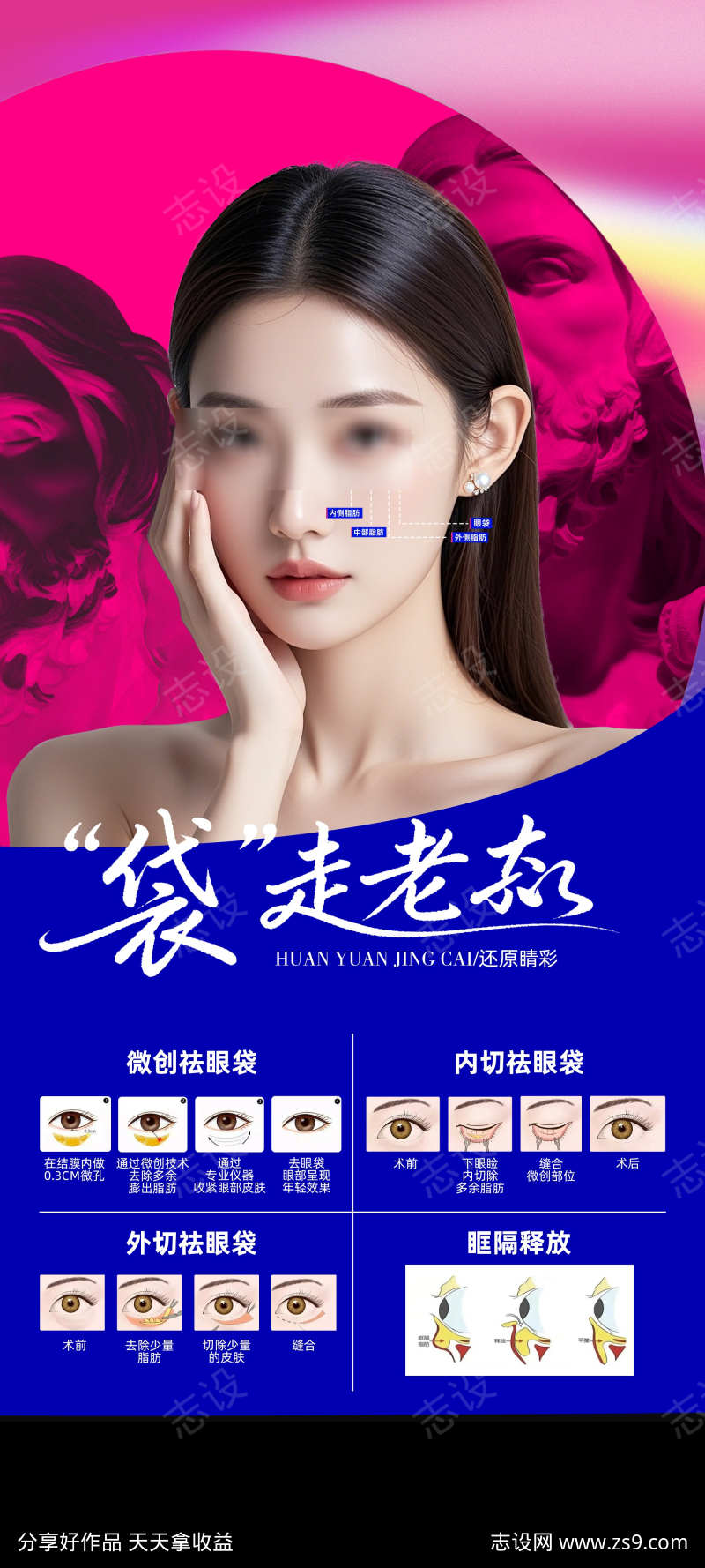 4种眼袋手术方式科普
