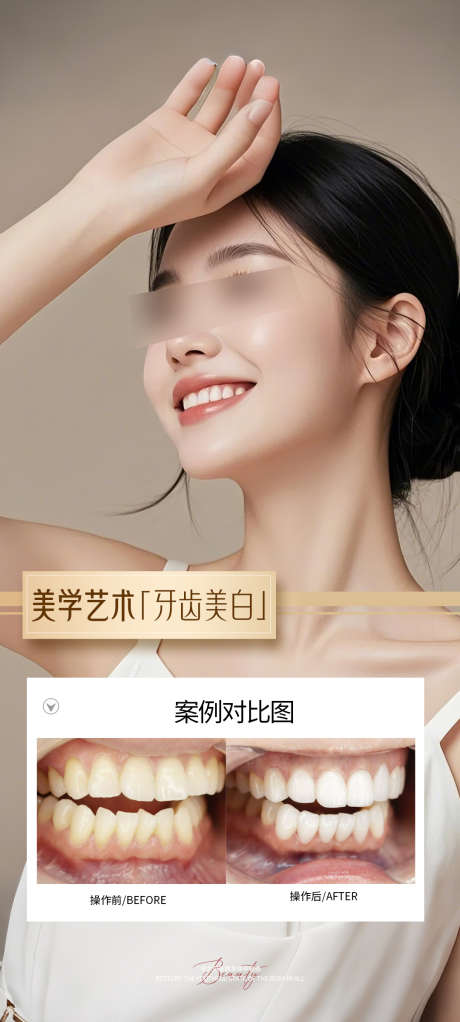 牙齿美白案例海报_源文件下载_PSD格式_1080X2400像素-海报,案例,牙科-作品编号:2025102015082258-志ˆ设˲͓͕͔͐͑͗ٚٛٙ网