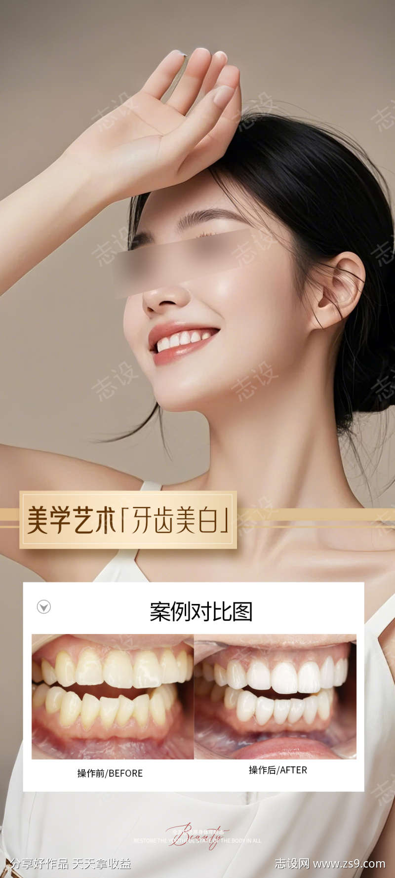 牙齿美白案例海报