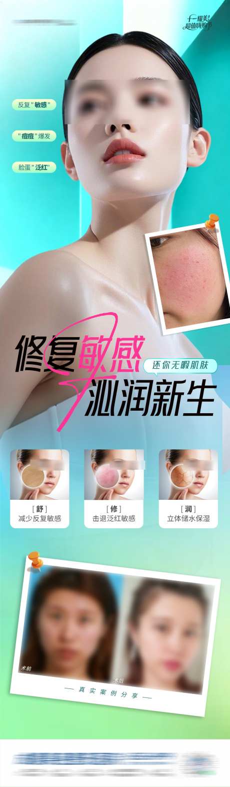 医美敏感修复案例对比创意长图海报_源文件下载_PSD格式_1284X4390像素-创意,质感,高端-作品编号:2025102609396900-志’设·网
