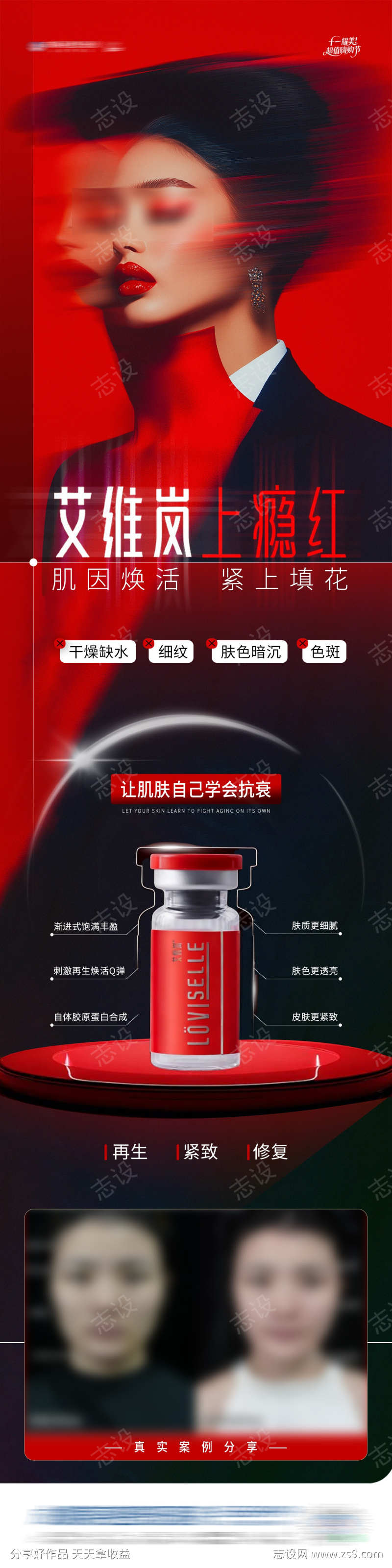 医美童颜水光针艾维岚上瘾红功效案例海报