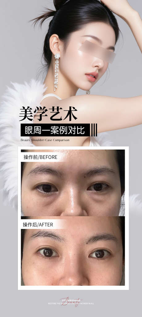眼周年轻化案例_源文件下载_PSD格式_1080X2400像素-海报,案例,泪沟-作品编号:2025110114438266-志‘设˱网