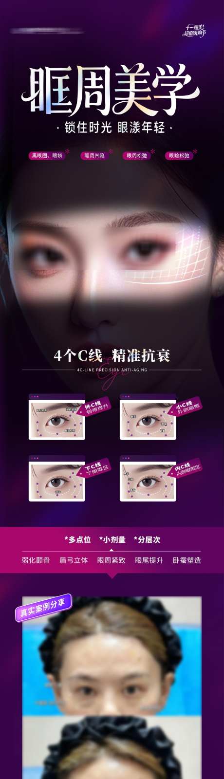 医美眼眶眼周抗衰美学案例对比创意海报_源文件下载_PSD格式_1284X5163像素-创意,质感,高端-作品编号:2025110317112119-志ˇ设˯网