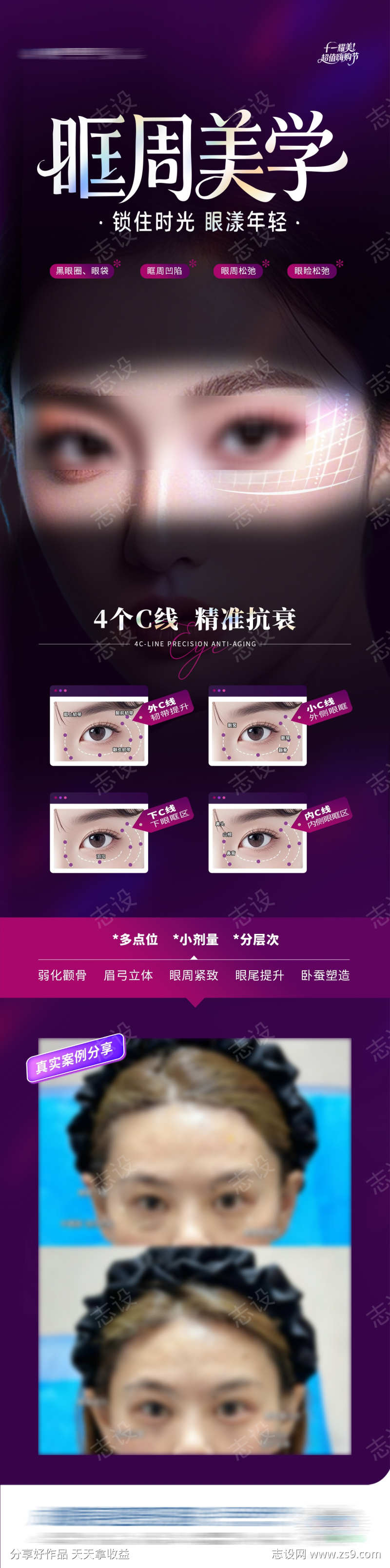医美眼眶眼周抗衰美学案例对比创意海报