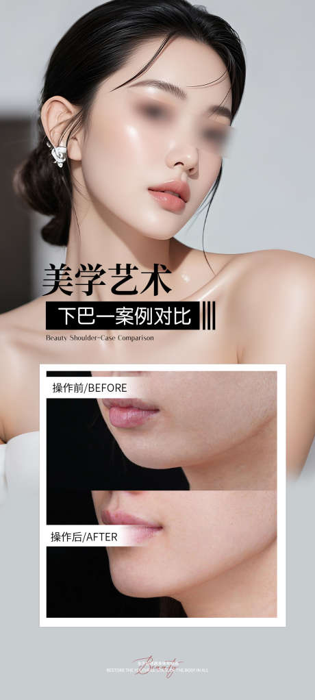 玻尿酸下巴案例_源文件下载_PSD格式_1080X2400像素-海报,案例,假体-作品编号:2025110413523975-志ʹ֣֤֚֫֗ׄ设˱网