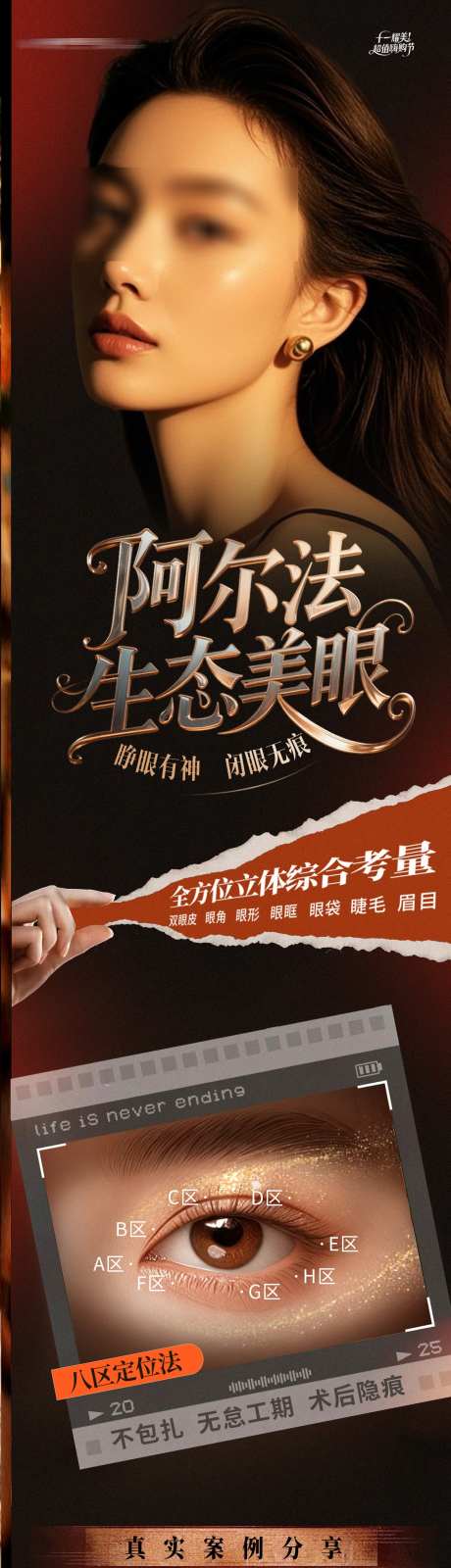 医美阿尔法生态美眼眼部整形案例对比海报_源文件下载_PSD格式_1284X6195像素-创意,质感,高端-作品编号:2025110609012581-志˜设˒网