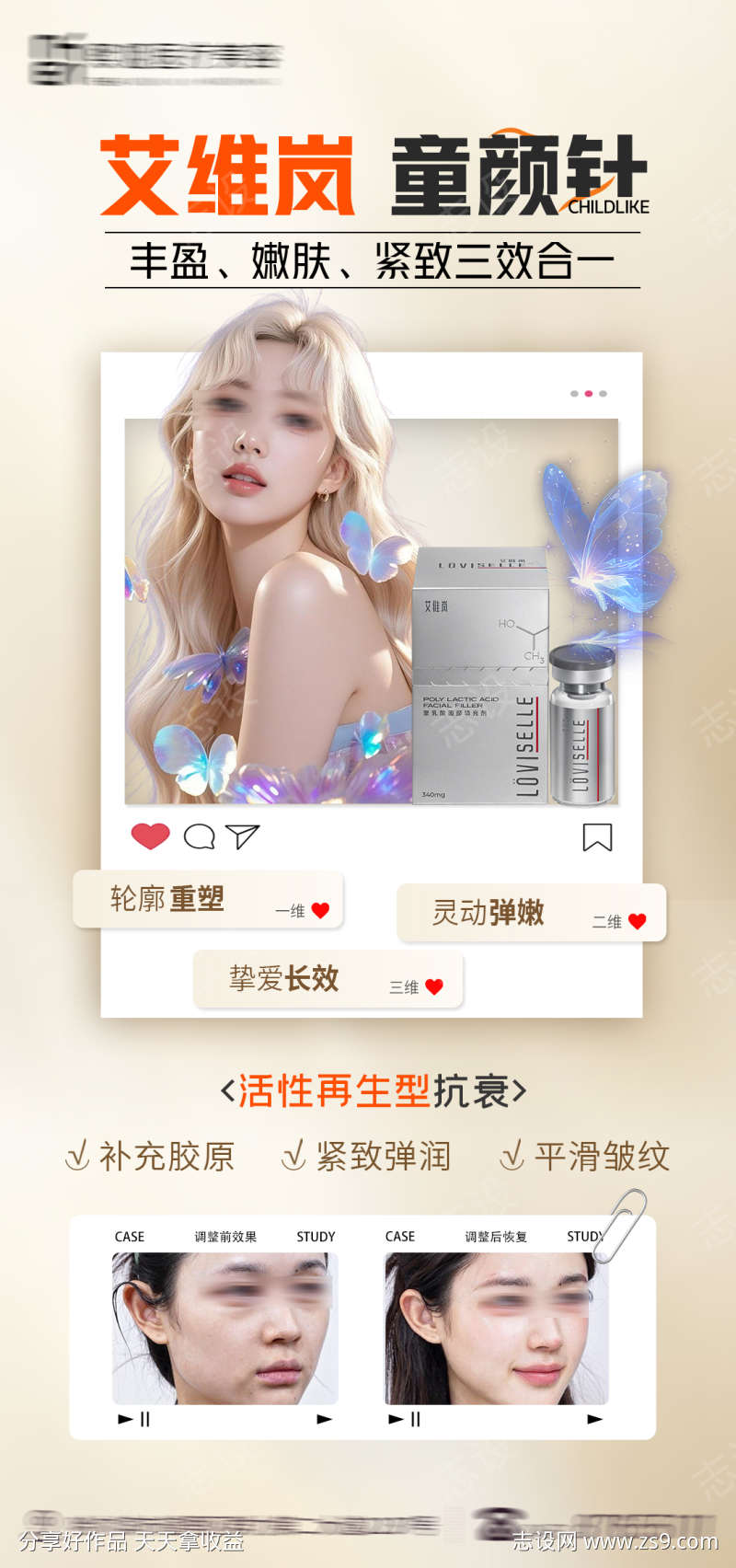 艾维岚童颜针海报