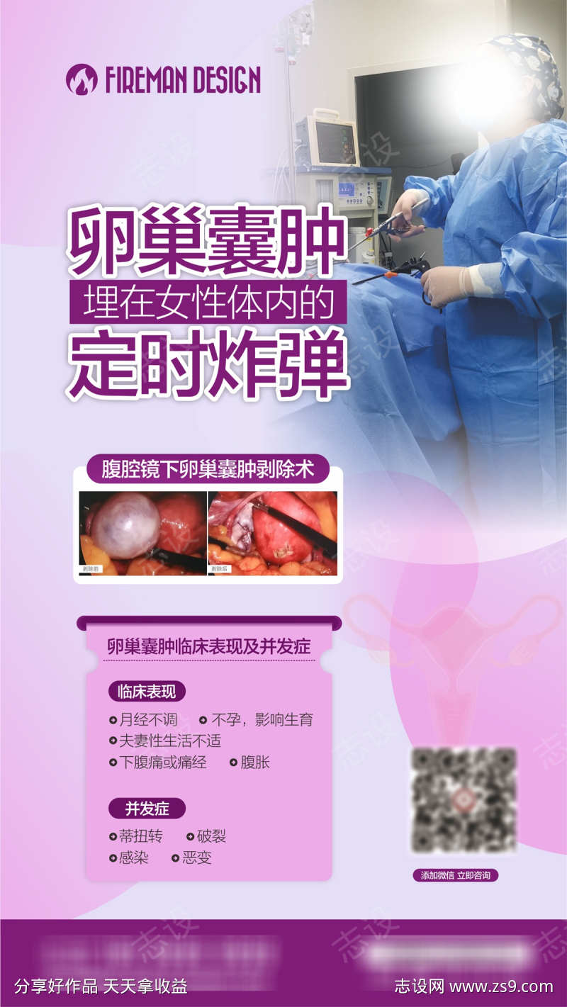 卵巢囊肿海报妇科广告
