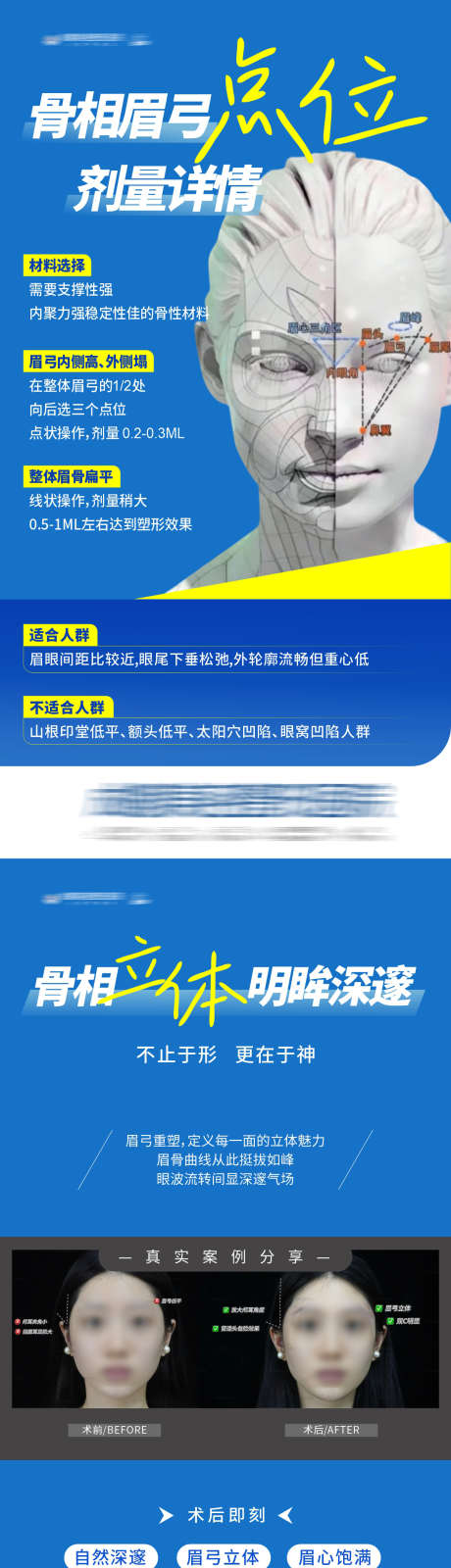 医美骨相眉弓整形塑美科普公众号海报_源文件下载_CDR格式_1200X4628像素-大气,版式,创意-作品编号:2025121416003589-志˯设͵网