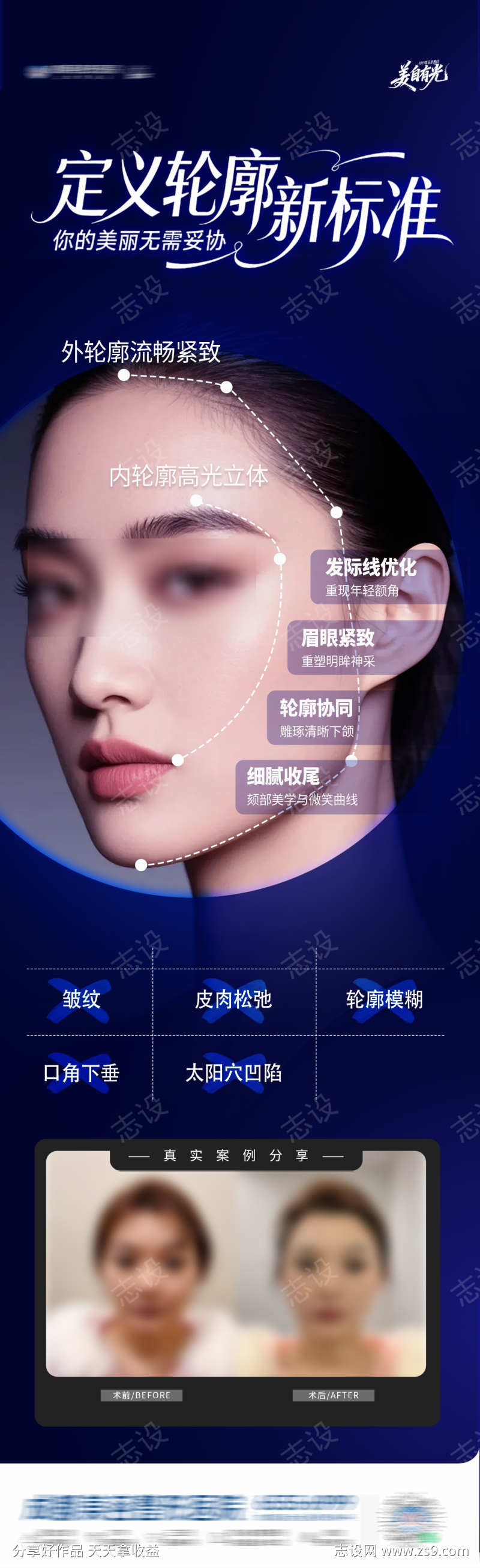 医美内外轮廓全面部提升案例创意海报