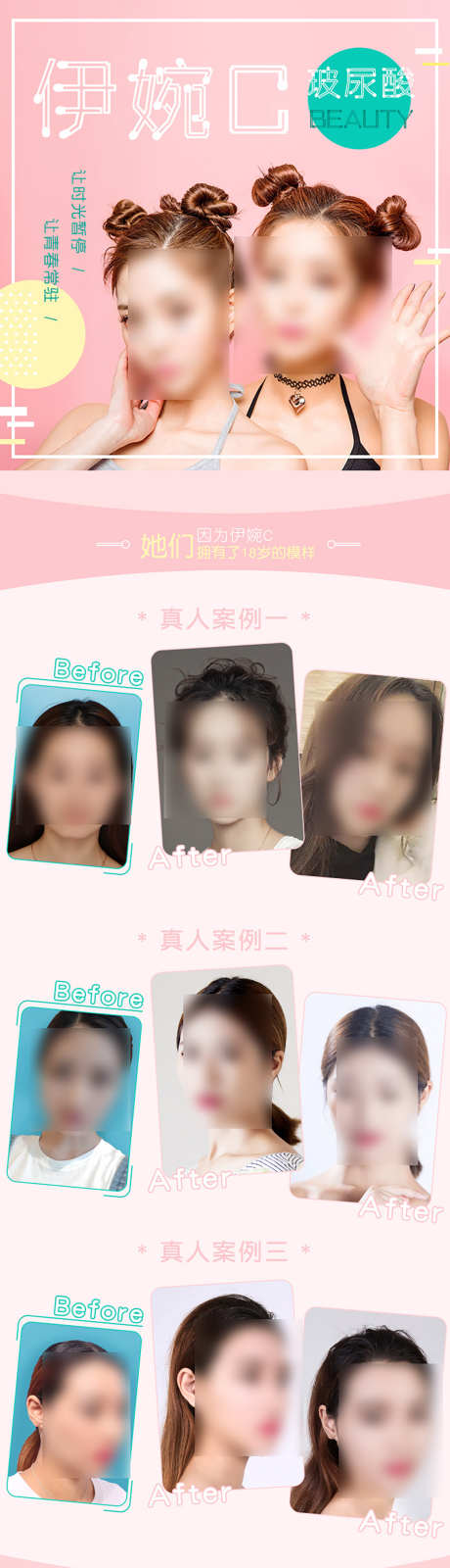 伊婉C玻尿酸海报