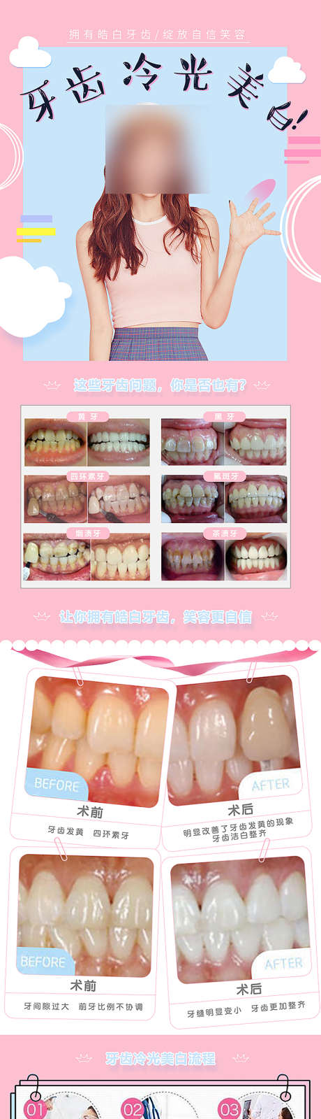 牙齿冷光美白详情页_源文件下载_PSD格式_850X4918像素-医疗保健,隐形矫正,固定矫正-作品编号:2026020809061079-志·设,网