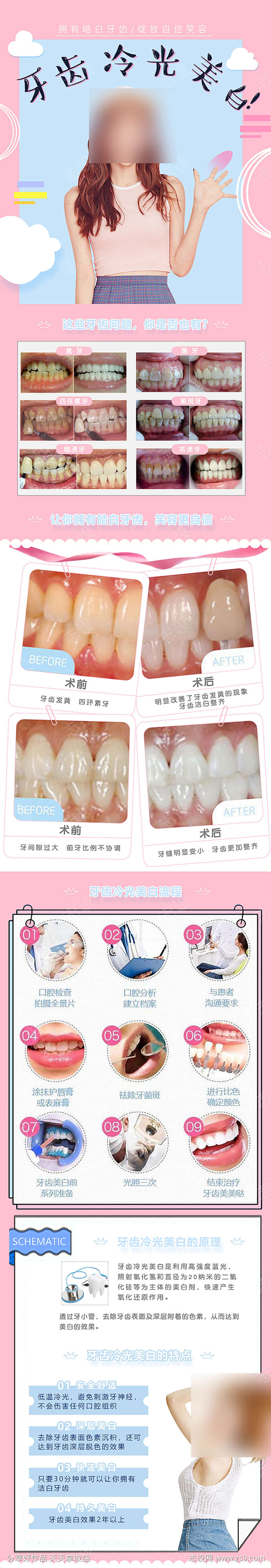 牙齿冷光美白详情页