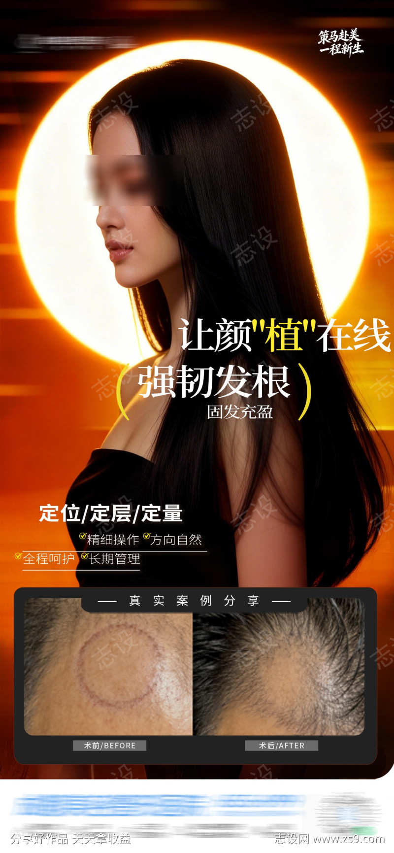 医美植发疤痕斑秃发根案例光影创意海报