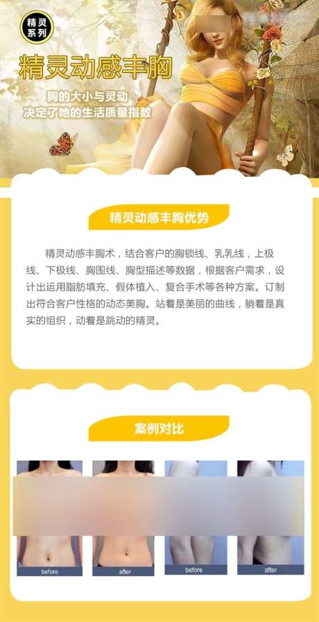 精灵动感丰胸术