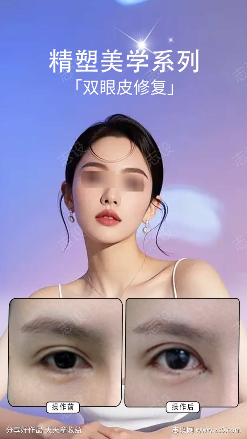 双眼皮修复案例海报