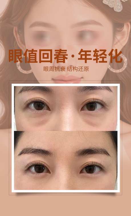 眼周案例海报