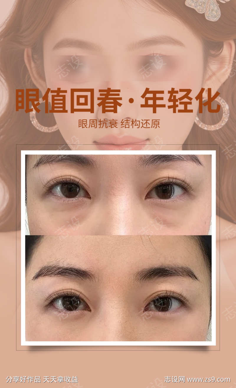 眼周案例海报
