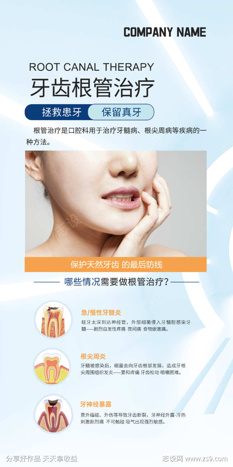 牙齿根管治疗技术