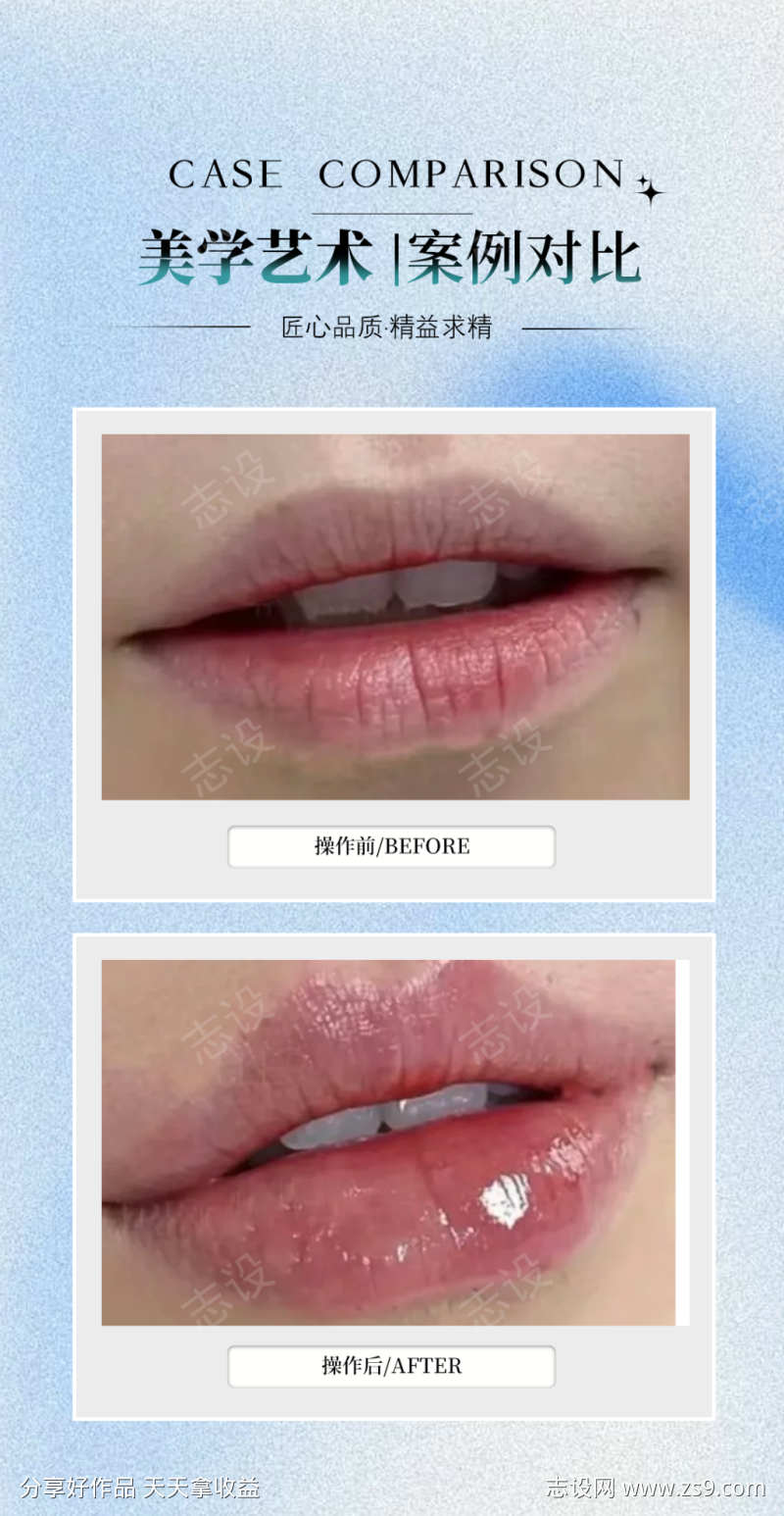 嘟嘟唇案例海报