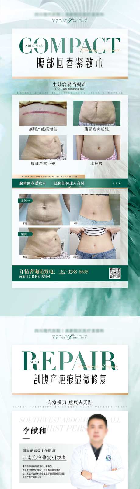 剖腹产疤痕修复腹壁紧致海报展架