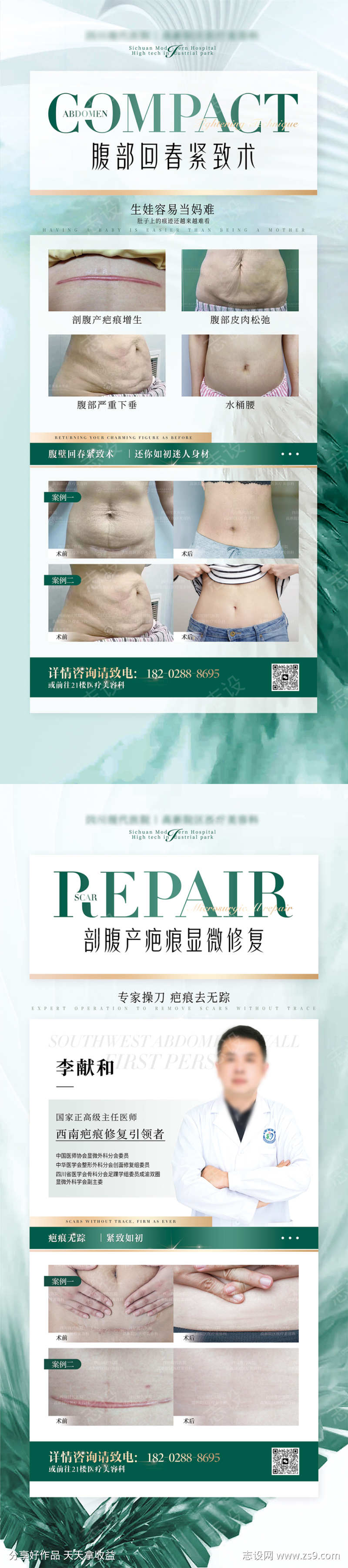 剖腹产疤痕修复腹壁紧致海报展架
