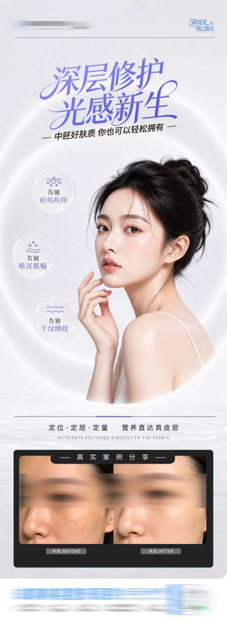 医美皮肤中胚层深层修护案例创意海报
