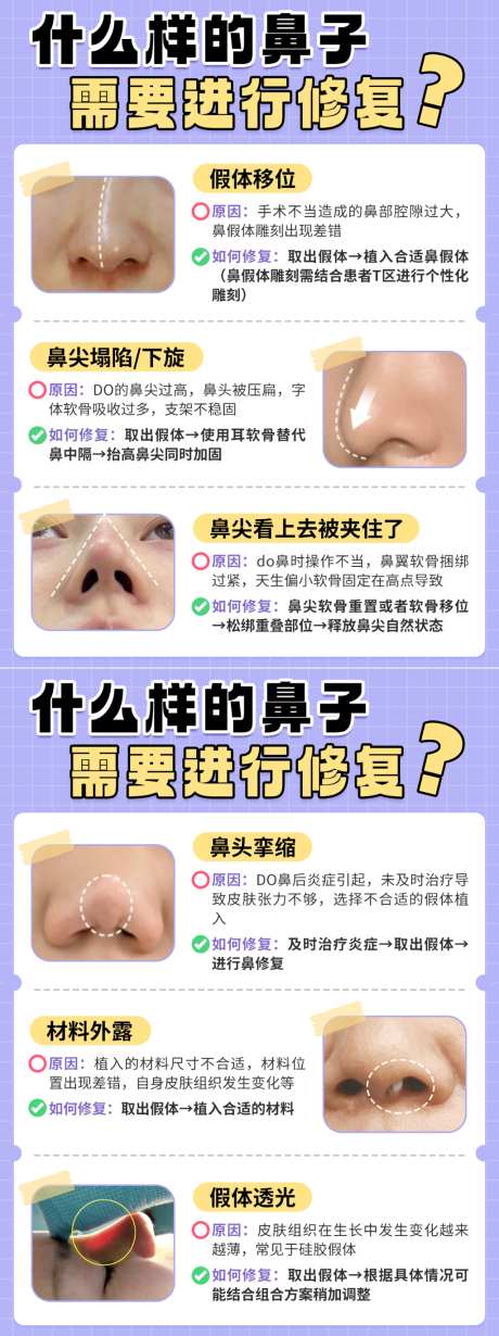 鼻修复医美小红书笔记封面海报_源文件下载_PSD格式_1024X1368像素-小红书,医美,鼻修复-作品编号:2026052409437308-志˘设˘网