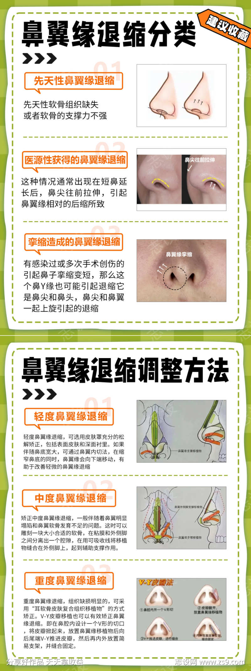 鼻翼缘退缩调整方法小红书医美笔记封面