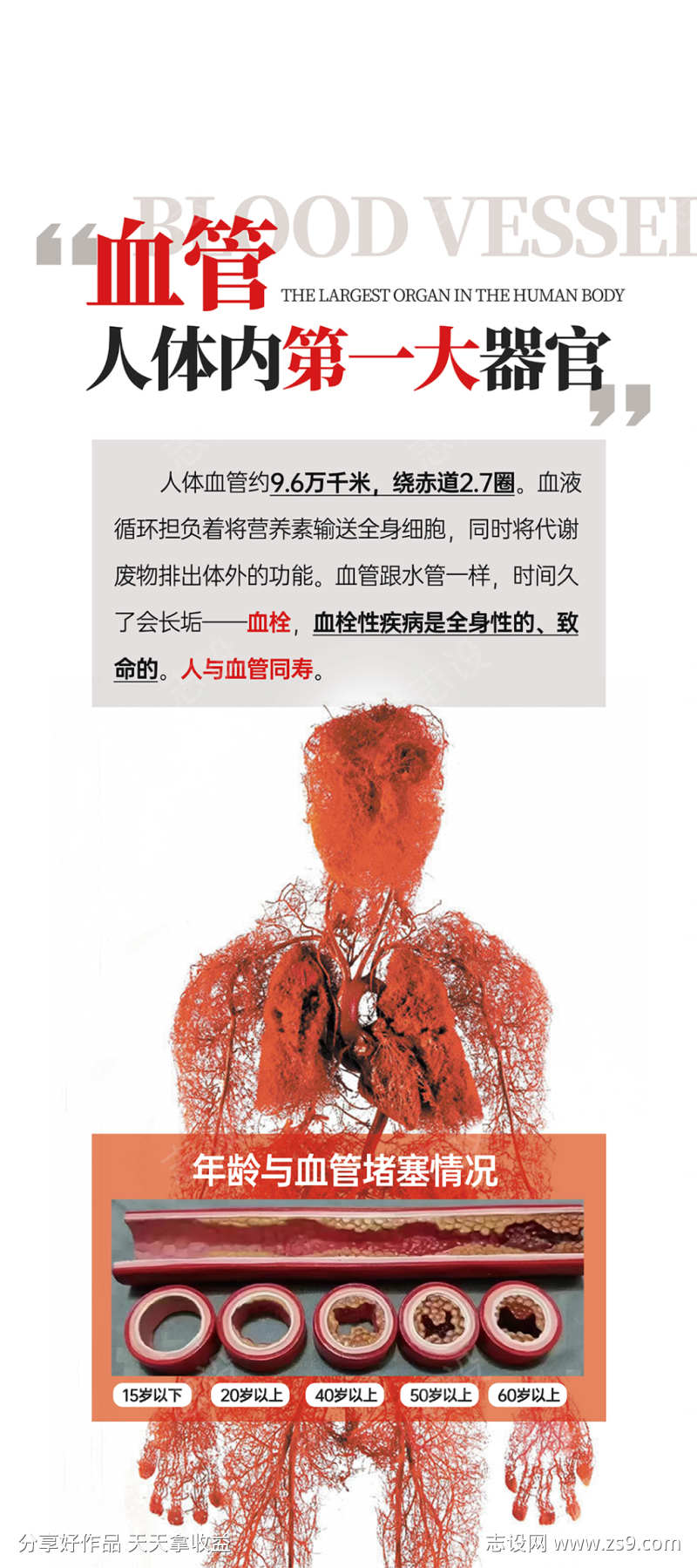 血管易拉宝