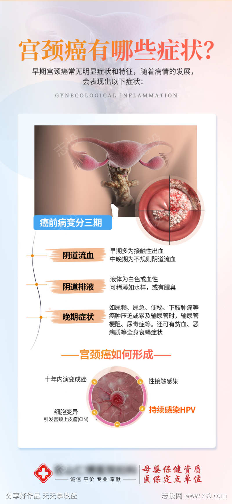 女性宫颈癌两癌筛查TCThpv海报