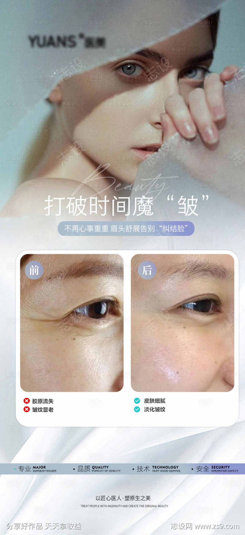 医美除皱案例对比图